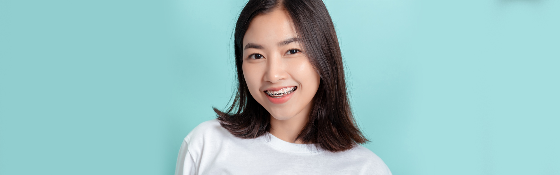 Everything You Should Know About Traditional Braces